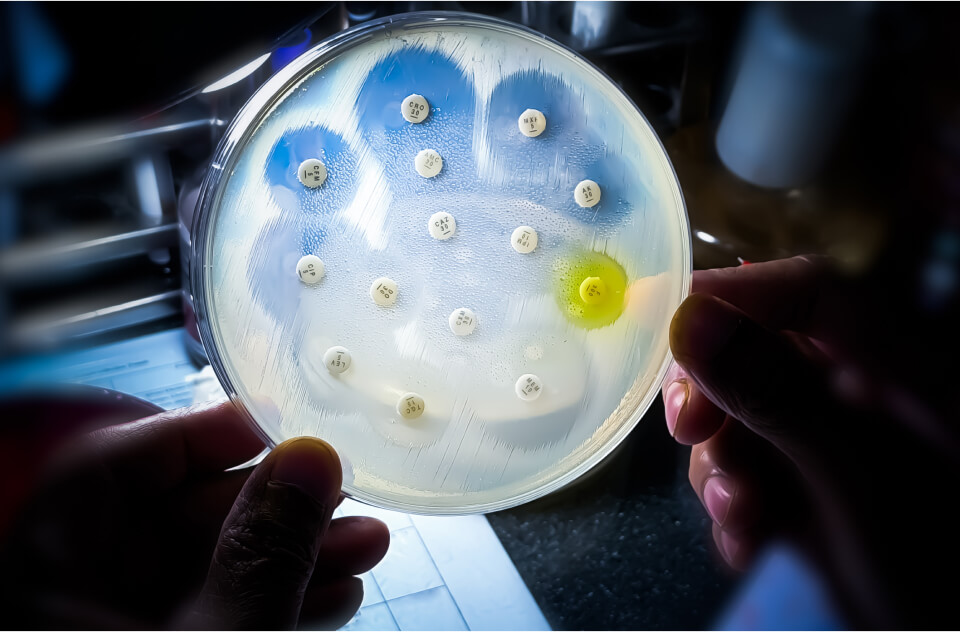Expanding the Modality Landscape Beyond Traditional Antibiotics
