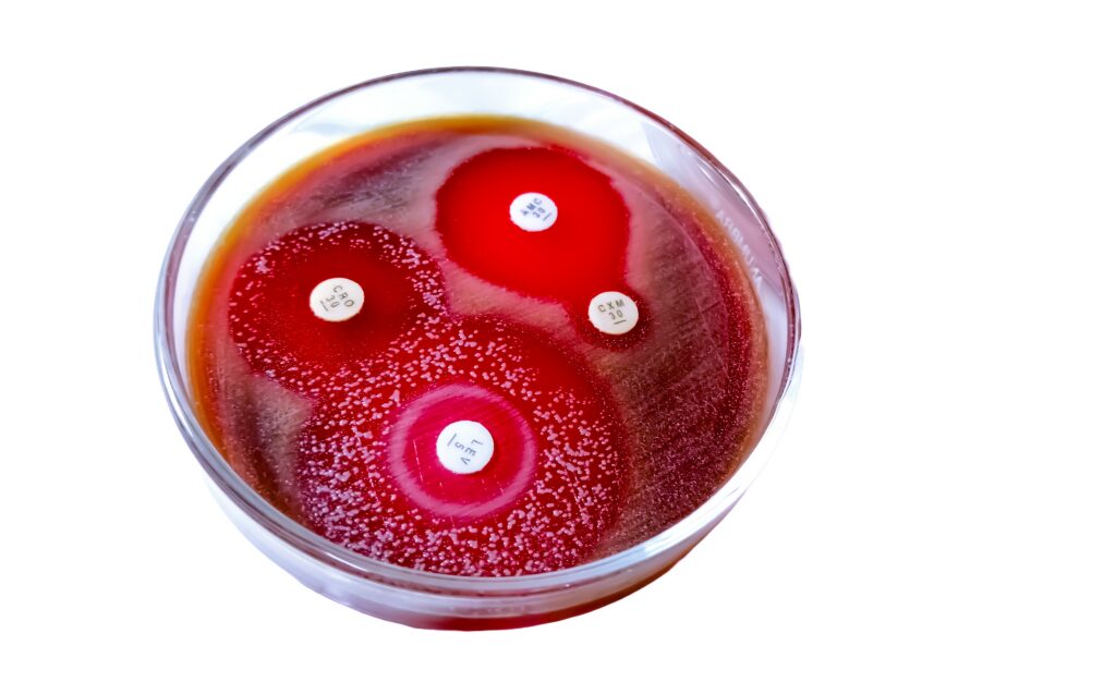 Can Hospitals Predict Antibiotic Resistance Before It Emerges?