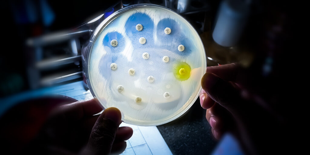 Do “Evolution-Proof” Antimicrobials Exist?